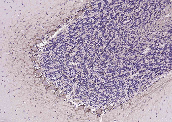 NEFM Recombinant Rabbit Monoclonal Antibody