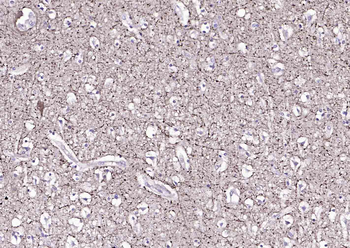 NEFM Recombinant Rabbit Monoclonal Antibody