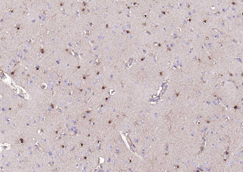 S100A1 Rabbit Polyclonal Antibody