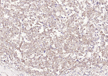 S100A1 Rabbit Polyclonal Antibody