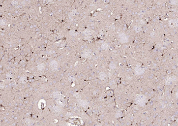 S100A1 Rabbit Polyclonal Antibody