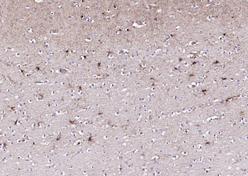 S100A1 Rabbit Polyclonal Antibody