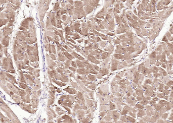 S100A1 Rabbit Polyclonal Antibody