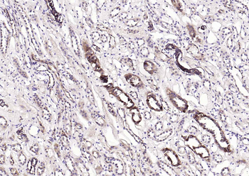 S100A1 Rabbit Polyclonal Antibody