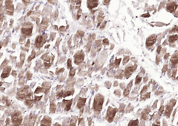 S100A1 Rabbit Polyclonal Antibody
