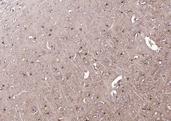 S100A1 Rabbit Polyclonal Antibody