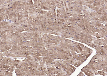 S100A1 Rabbit Polyclonal Antibody