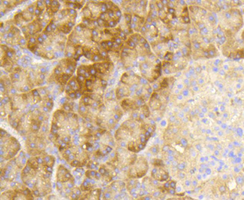 Phospho-EIF2S1 (Ser51) Recombinant Rabbit Monoclonal Antibody