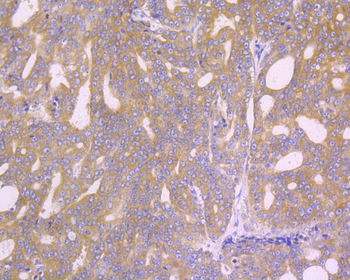 Phospho-EIF2S1 (Ser51) Recombinant Rabbit Monoclonal Antibody