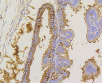Phospho-EIF2S1 (Ser51) Recombinant Rabbit Monoclonal Antibody