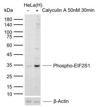 Phospho-EIF2S1 (Ser51) Recombinant Rabbit Monoclonal Antibody
