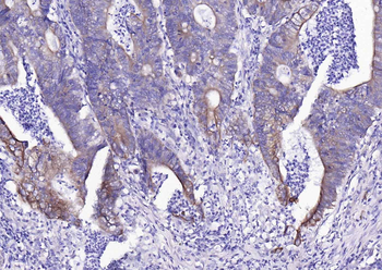 ACVRL1 Rabbit Polyclonal Antibody