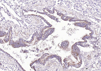 ACVRL1 Rabbit Polyclonal Antibody