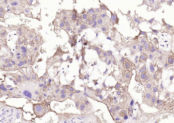 ACVRL1 Rabbit Polyclonal Antibody