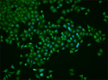 NFKB2 Rabbit Polyclonal Antibody