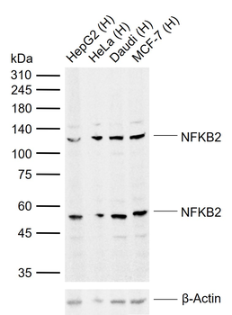 NFKB2 Rabbit Polyclonal Antibody