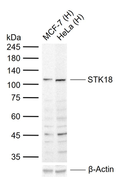 STK18 Rabbit Polyclonal Antibody
