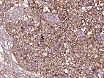 MUC13 Rabbit Polyclonal Antibody