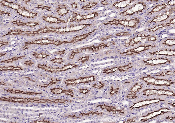 MUC13 Rabbit Polyclonal Antibody
