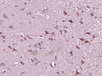 CWH43 Rabbit Polyclonal Antibody