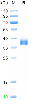 Recombinant SARS-Cov-2 Spike RBD protein (BA.5/Omicron), His (HEK293)