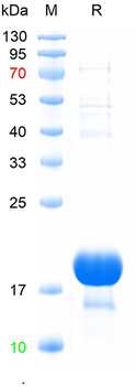 Recombinant Rat IL-18 protein, N-His