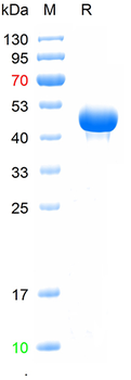 Recombinant human Renin protein, C-His (HEK293)