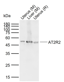 AT2R2 Rabbit Polyclonal Antibody