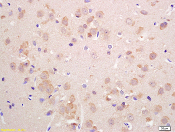 VGLUT2 Rabbit Polyclonal Antibody