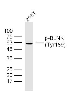 Phospho-BLNK (Tyr189) Rabbit Polyclonal Antibody