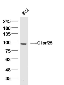 C1orf25 Rabbit Polyclonal Antibody