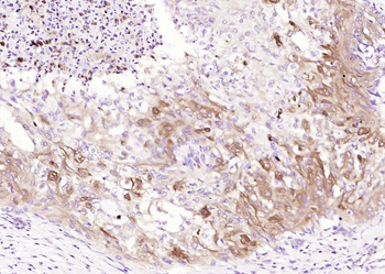 MARCH6 Rabbit Polyclonal Antibody