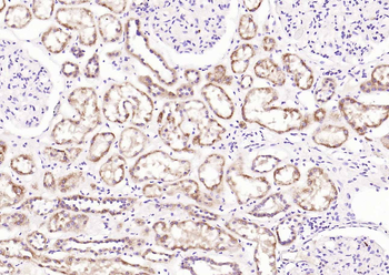 MARCH6 Rabbit Polyclonal Antibody