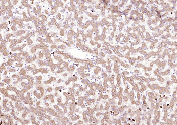 MARCH6 Rabbit Polyclonal Antibody