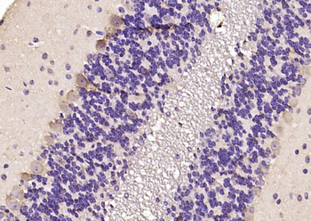 MARCH6 Rabbit Polyclonal Antibody