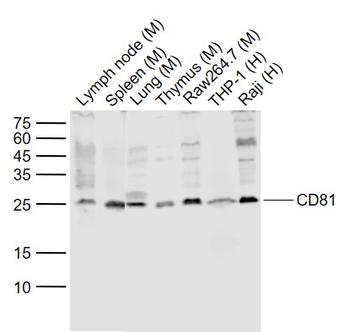 CD81 Rabbit Polyclonal Antibody