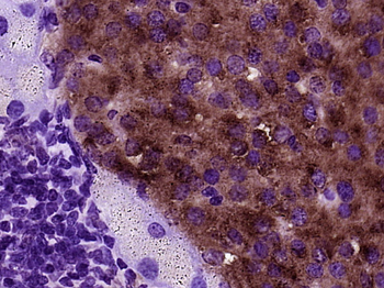 BTBD17 Rabbit Polyclonal Antibody