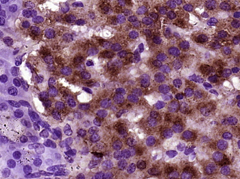 BTBD17 Rabbit Polyclonal Antibody