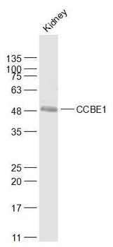 CCBE1 Rabbit Polyclonal Antibody