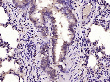 CHD3 Rabbit Polyclonal Antibody