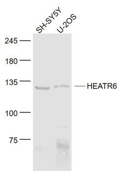 HEATR6 Rabbit Polyclonal Antibody