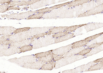 ITGB1BP2 Rabbit Polyclonal Antibody