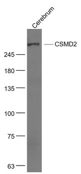 CSMD2 Rabbit Polyclonal Antibody