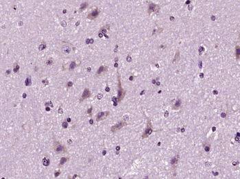 Phospholipase C beta 2 Rabbit Polyclonal Antibody