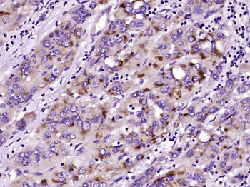 Phospholipase C beta 2 Rabbit Polyclonal Antibody