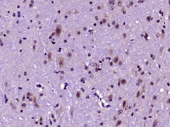 Phospholipase C beta 2 Rabbit Polyclonal Antibody