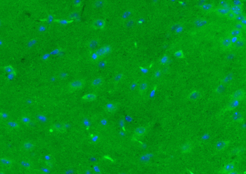 Phospholipase C beta 2 Rabbit Polyclonal Antibody