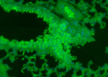 Phospholipase C beta 2 Rabbit Polyclonal Antibody