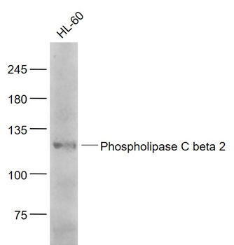 Phospholipase C beta 2 Rabbit Polyclonal Antibody