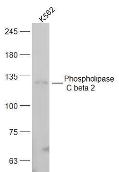 Phospholipase C beta 2 Rabbit Polyclonal Antibody